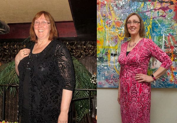 Michelle before and after